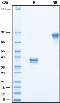 R&D Systems Recombinant Cynomolgus/Rhesus Macaque BCMA Fc P
