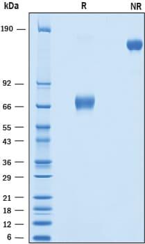 R&D Systems Recombinant Human OLT-2/TARM1 Fc Chimera Protei