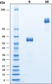 R&D Systems rmSiglec-15 Fc CF (50 UG)