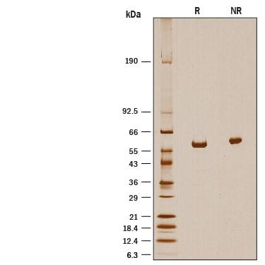 R&D Systems Recombinant Human ALDH1A2 His-tag CF (20 UG)