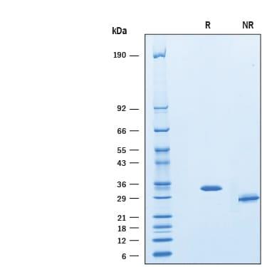 R&D Systems Recombinant Human IGFBP-rp1/IGFBP-7 Protein CF