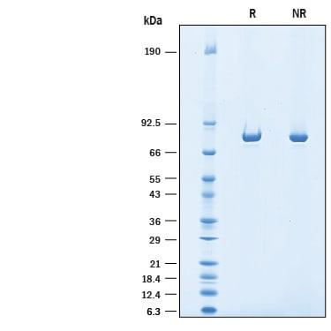 R&D Systems Recombinant Human F13A1 His-tag Protein CF (50 U