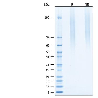 R&D Systems Recombinant Mouse Serglycin/SRGN His-tag Protein
