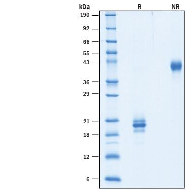 R&D Systems rcyno/rrmIL-17F His (50 UG)