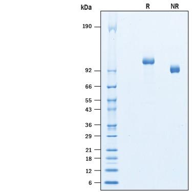 R&D Systems rhRECK His CF (50 UG)