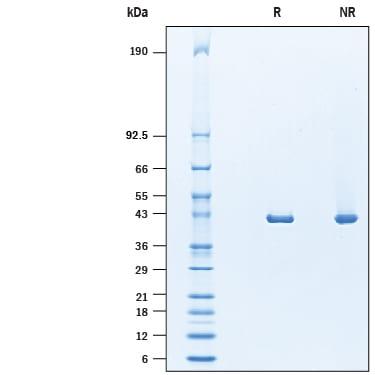 R&D Systems rhACAT1 His CF (20 UG)