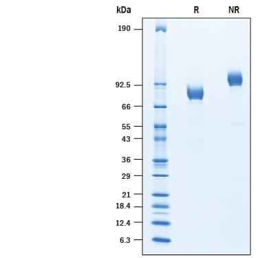 R&D Systems rhITIH1 His CF (50 UG)