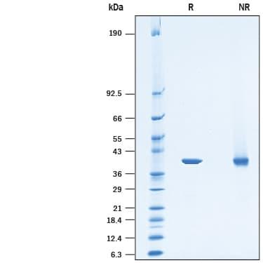 R&D Systems rhPSAT1 His CF (50 UG)