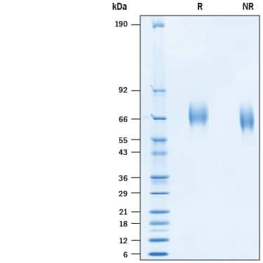 R&D Systems rhTyro3 His CF (100 UG)