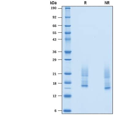 R&D Systems rmIL-31 CF (10 UG)