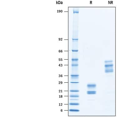 R&D Systems rmIL-17F (50 UG)