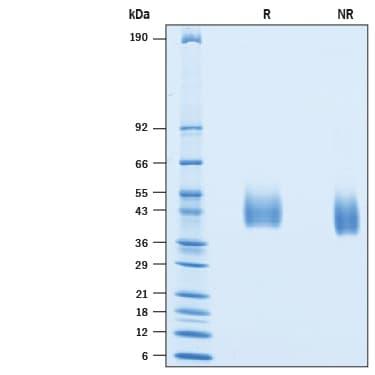 R&D Systems rhMICB His CF (50 UG)