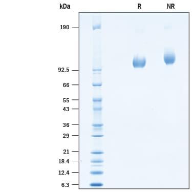 R&D Systems rcynoPSMA His CF (20 UG)