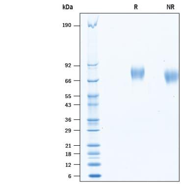 R&D Systems rhAxl His CF (100 UG)