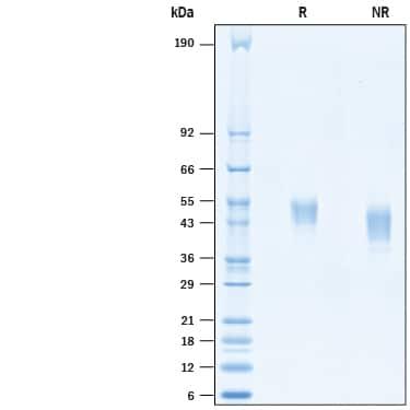 R&D Systems Recombinant Human LRRC24 His-tag Protein CF (50