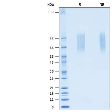 R&D Systems Recombinant Human CD68/SR-D1 His-tag Protein CF