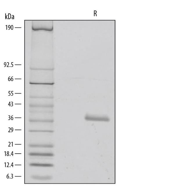 R&D Systems Recombinant Human IGFBP-rp1/