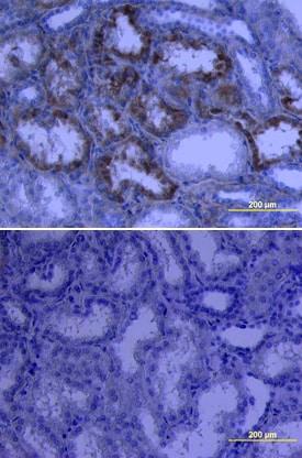 R&D Systems Human Endostatin Biotinylate